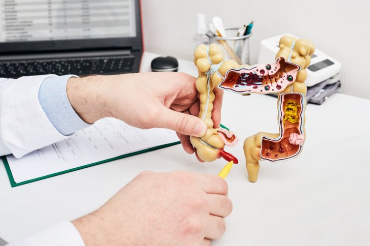 Appendicitis: Everything You Need to Know