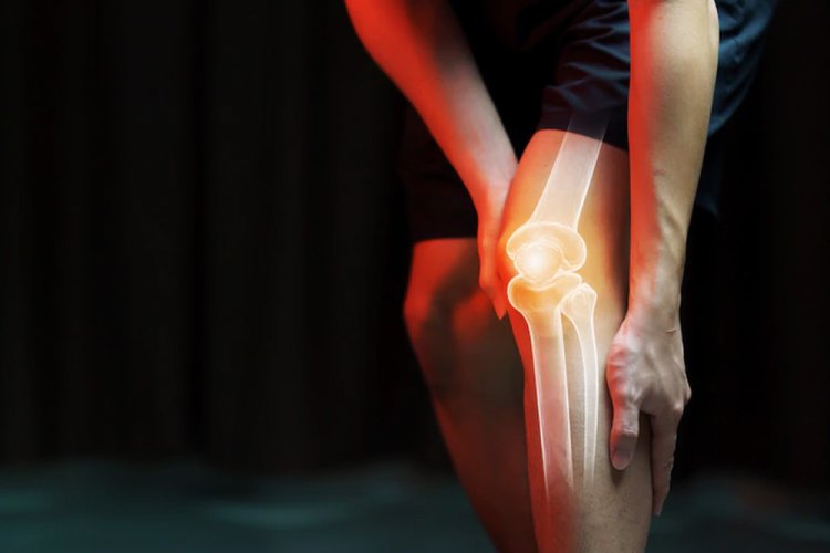 All you need to know about Arthritis