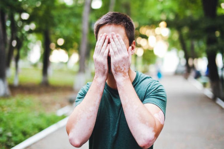 All you need to know about Autoimmune Disorder