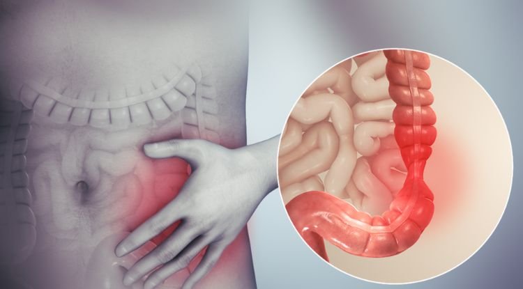 Bowel Movement Symptoms