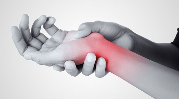 Carpal Tunnel Syndrome Symptoms