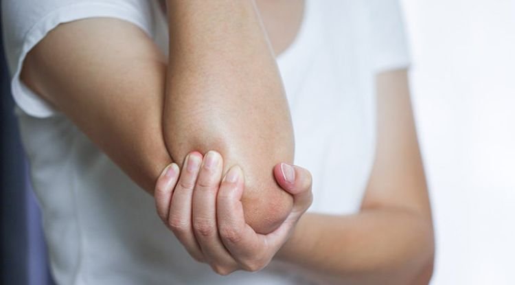 Myositis Symptoms