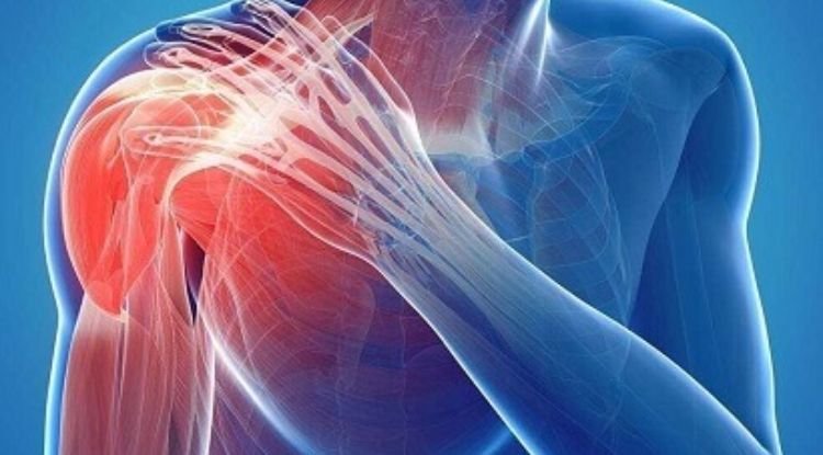 Shoulder Injuries And Disorders Symptoms
