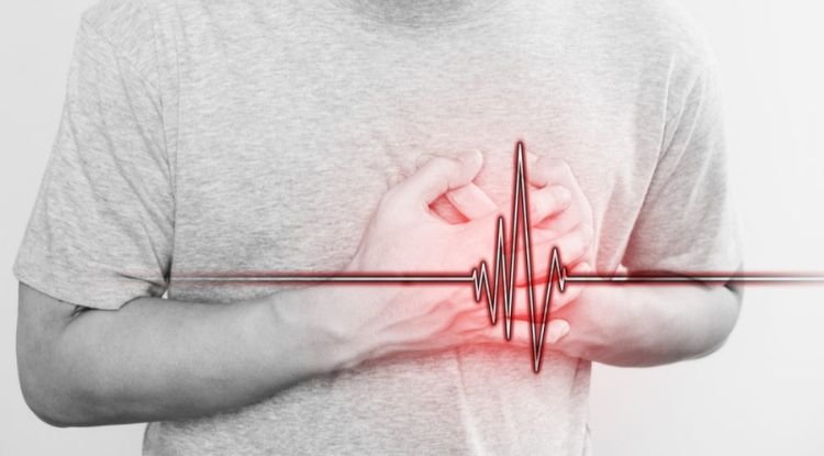 Angina Symptoms