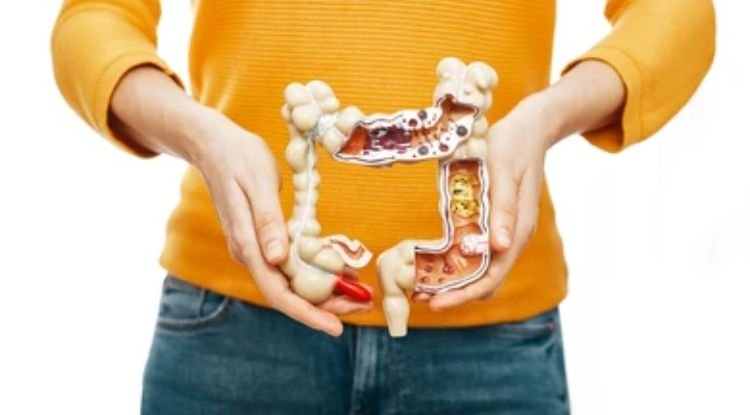 Crohn's Disease Symptoms