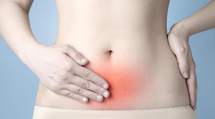 Endometriosis Symptoms