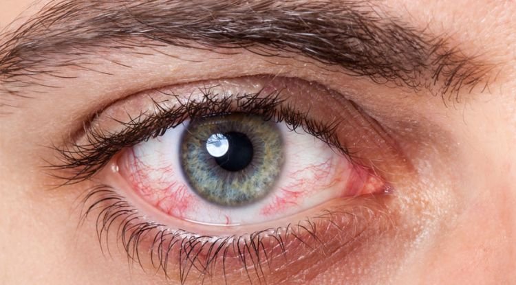 Eye Cancer Symptoms