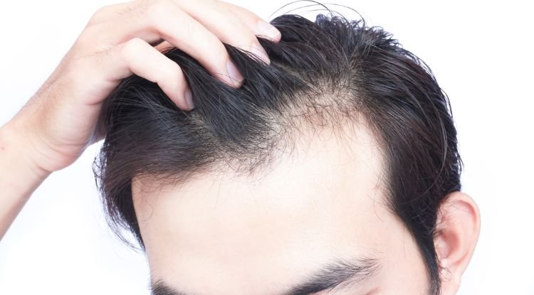 Hair Loss Symptoms
