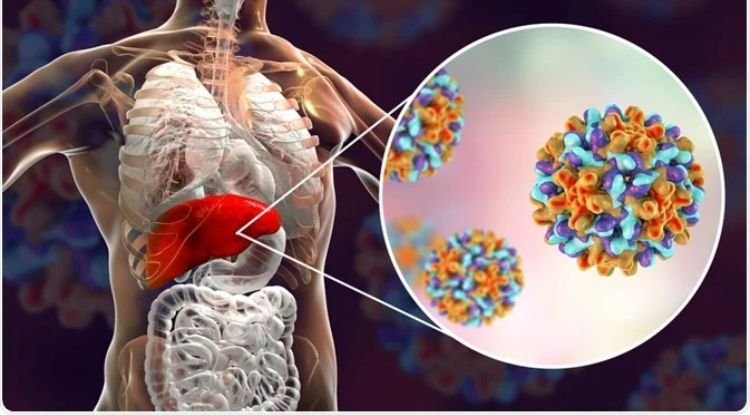 Hepatitis A Symptoms