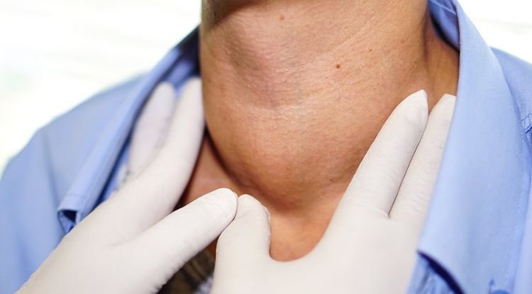 Hyperthyroidism Symptoms