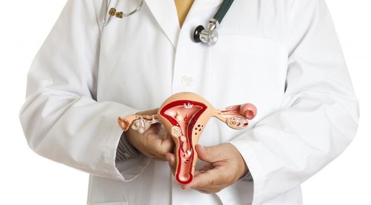 Ovarian Cysts Symptoms
