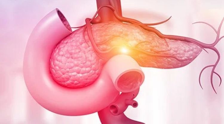 Pancreatic Cancer Symptoms