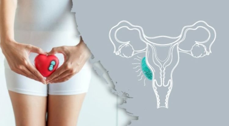 Vulvar Cancer Symptoms